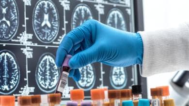 Neurologia, la rivoluzione dei biomarcatori: così si scoprono le malattie prima dei sintomi