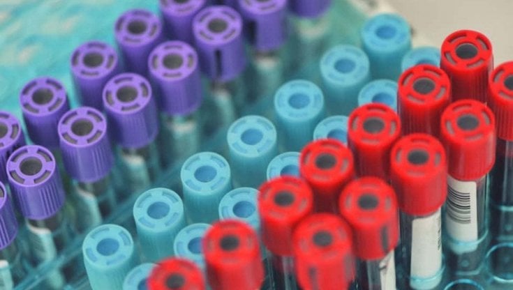 test del dna fetale a poche decine di
