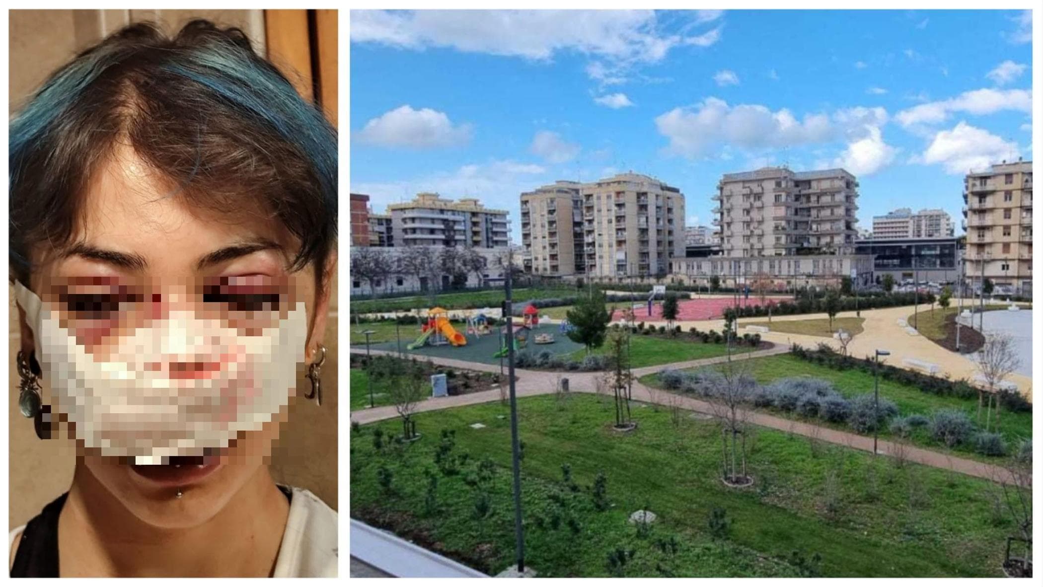 Bari, ragazza aggredita nel bagno di parco Rossani: tra autori due minori. Il Comune parte civile