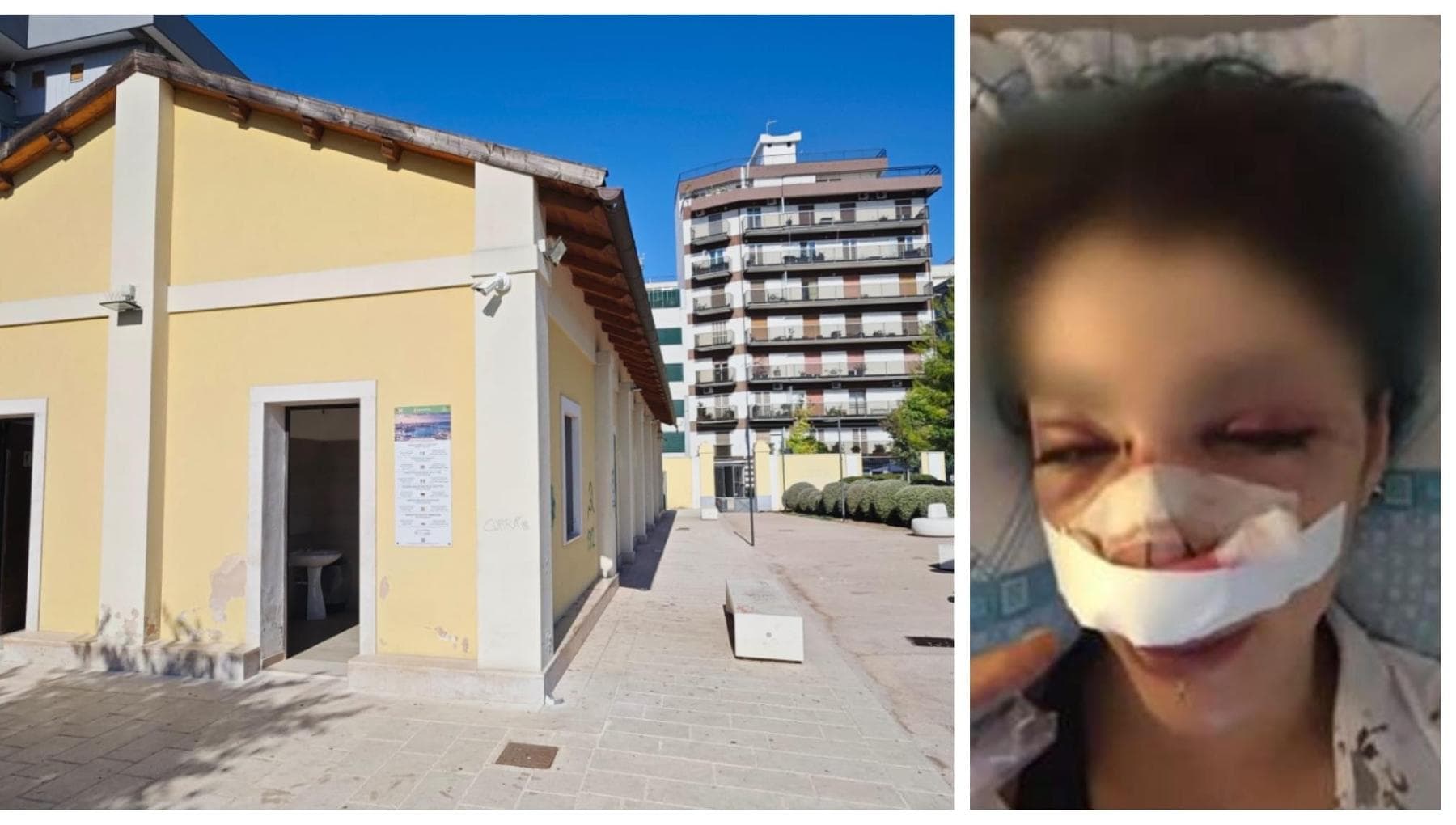 Aggressione Giuditta D’Elia nel parco Rossani: arrestata l’addetta ai bagni. Altre 4 donne indagate