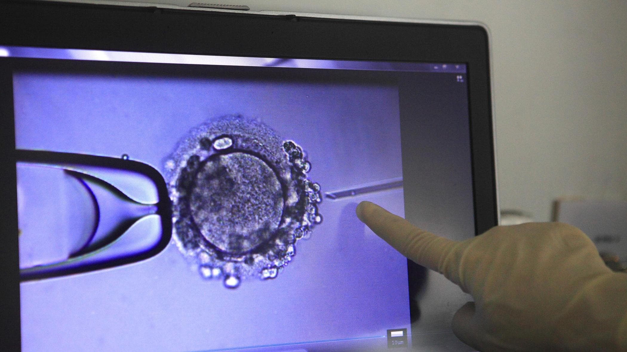Embrioni scambiati, due biologhe sotto shock, stretta sui protocolli dopo lo stop del ministero