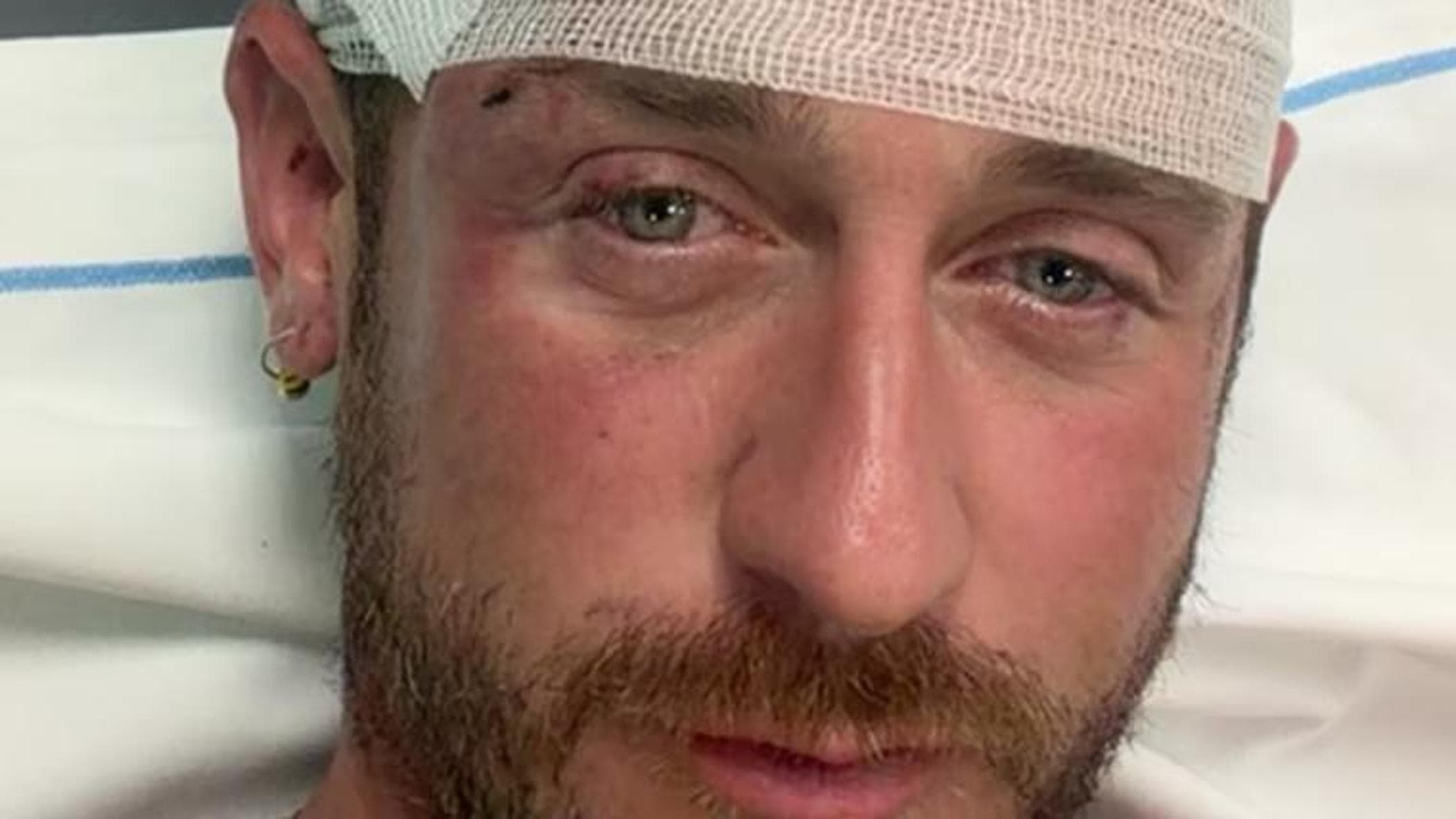 aggredito e picchiato da 30 persone a olbia perch233 sono gay la denuncia del promoter angelo ratti da Milano.repubblica.it aggredito e picchiato da 30 persone a olbia perch233 sono gay la denuncia del promoter angelo ratti