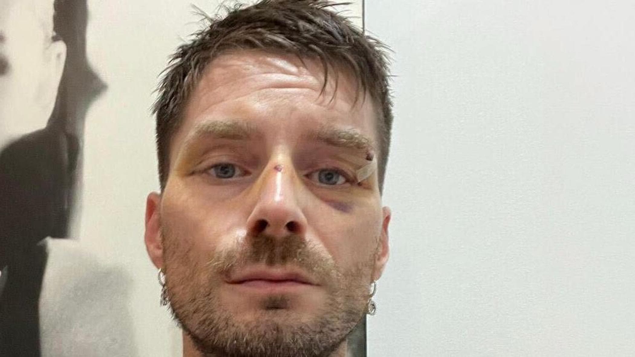 Il direttore di Novella 2000 Luca Burini aggredito da sconosciuti a Milano: “Avevano fame di sangue”