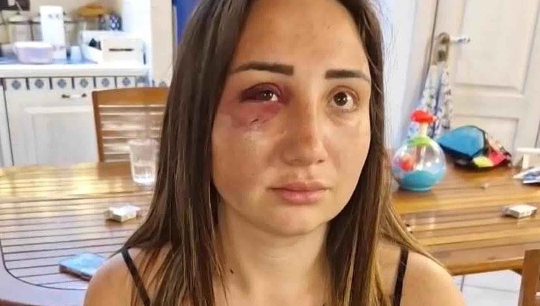 Gaia, la ragazza picchiata dal suo ex a Pozzuoli: “Appena lo liberano torna e mi ammazza” - la Repubblica