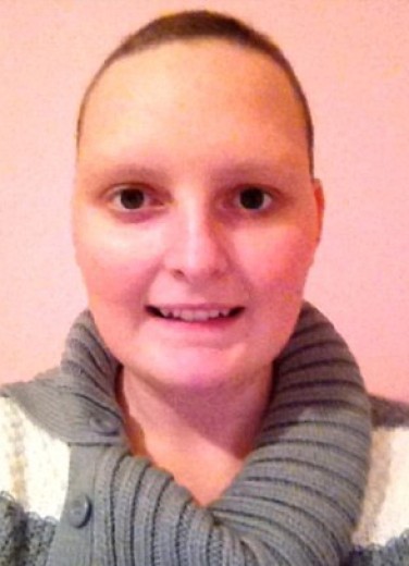 Tornano i capelli dopo il cancro, la rinascita di Annmarie diventa un fotoracconto