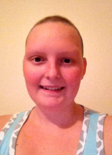 Tornano i capelli dopo il cancro, la rinascita di Annmarie diventa un fotoracconto