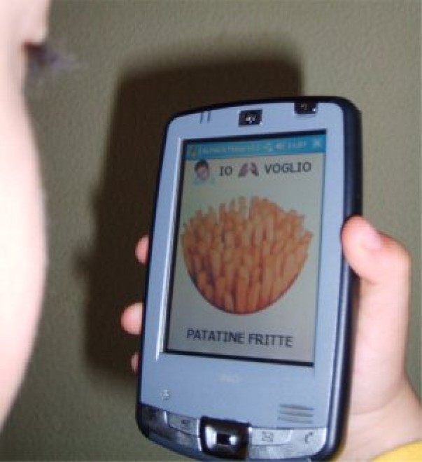 Autismo, una fascia "smart" aiuta i bimbi