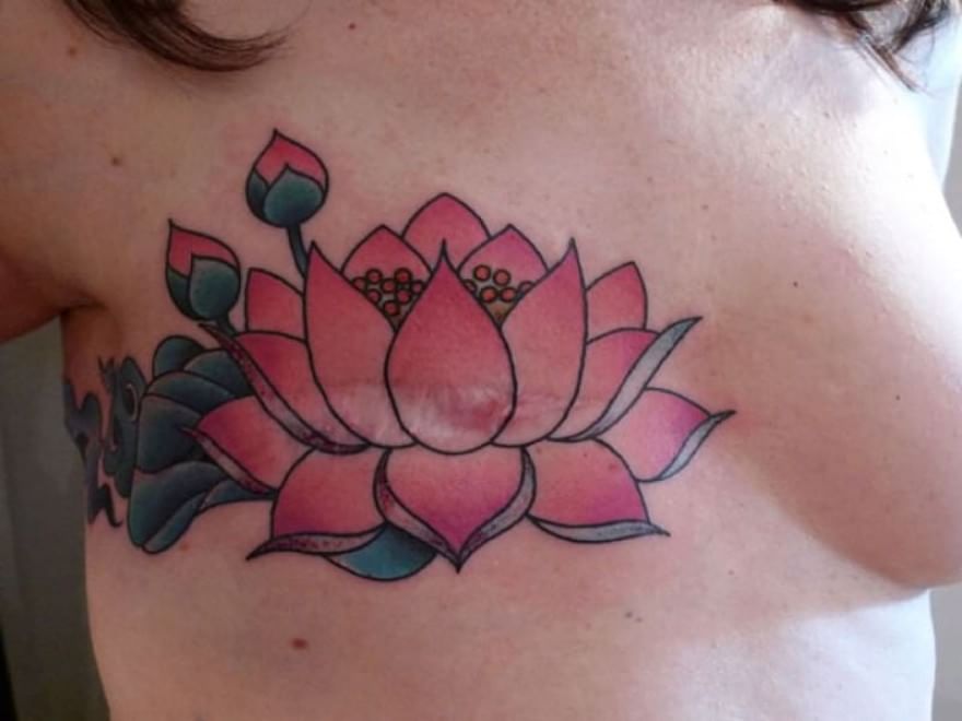 Tatuaggi, il decalogo per rimuoverli