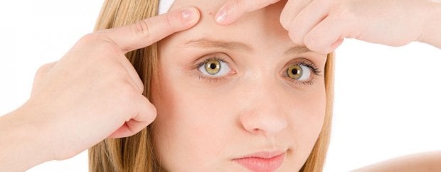 Come combattere l'acne