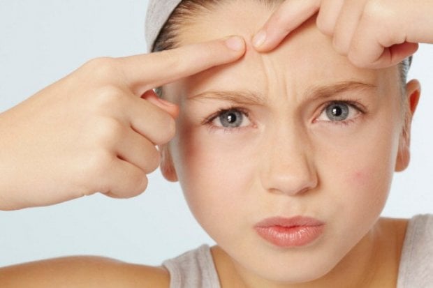 Come combattere l'acne