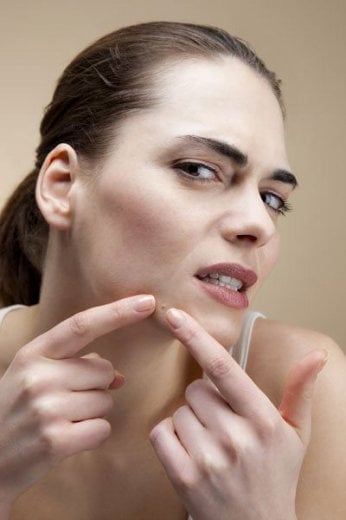 Come combattere l'acne