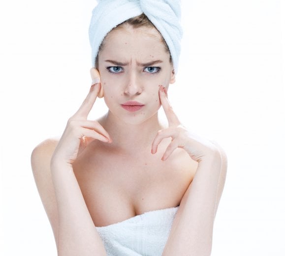 Come combattere l'acne
