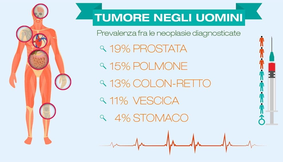 I numeri dei tumori in Italia