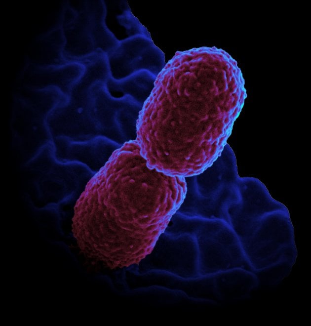 I batteri resistenti agli antibiotici