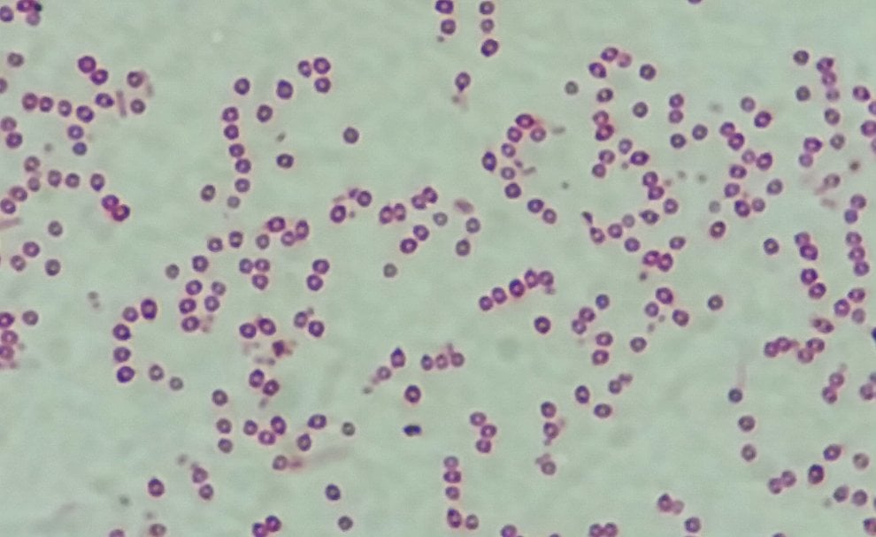 I batteri resistenti agli antibiotici