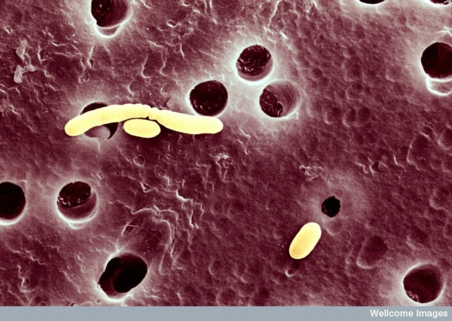 I batteri resistenti agli antibiotici