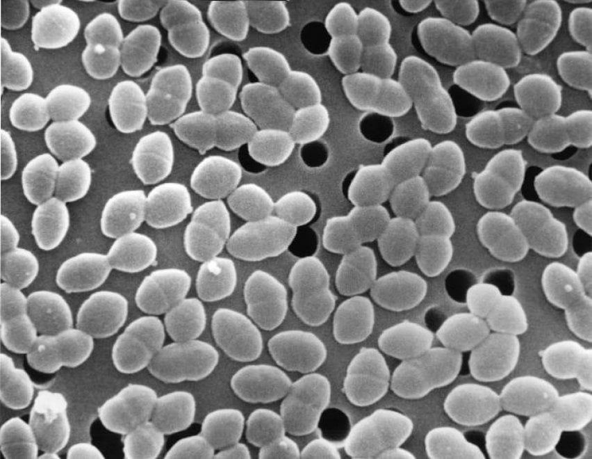 I batteri resistenti agli antibiotici