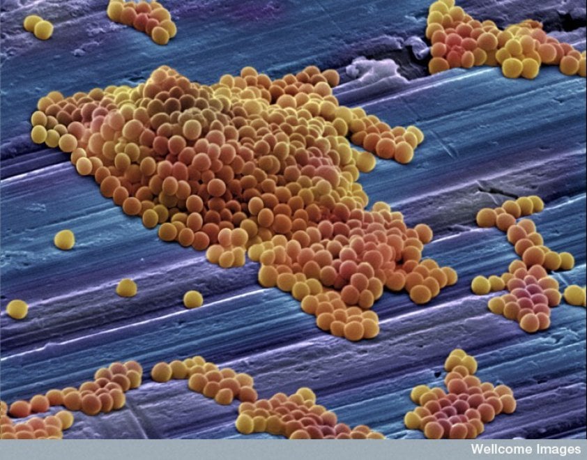I batteri resistenti agli antibiotici