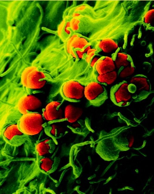 I batteri resistenti agli antibiotici