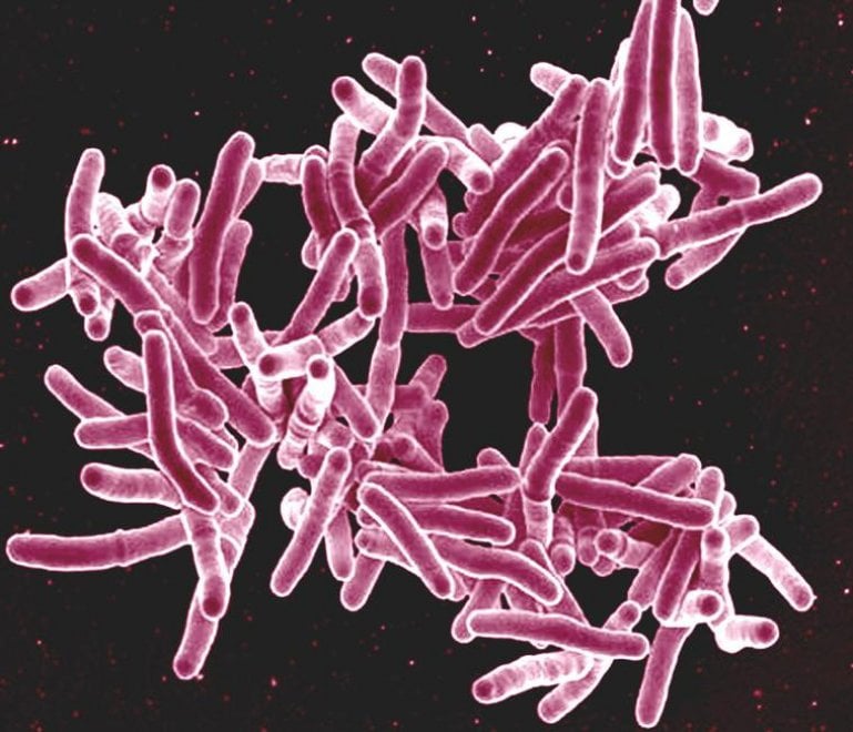 I batteri resistenti agli antibiotici