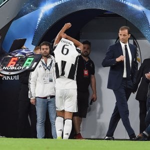 Juventus, Khedira rassicura: ''Nulla di grave''. Pronto per la finale di coppa Italia