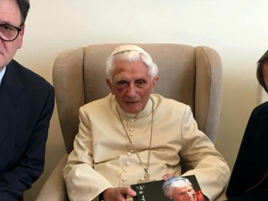 Benedetto XVI cade e si fa un occhio nero: sta bene