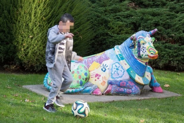 Hassan, il bambino farfalla che può tornare a giocare a pallone