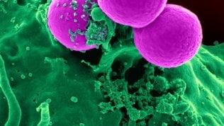 <a href="https://puntoitalia.online/dossier/salute/geni-contro-il-cancro/2018/08/31/news/le_immunoterapie_contro_il_cancro-205325478/" class="Articolo">Immunoterapie contro il cancro</a>