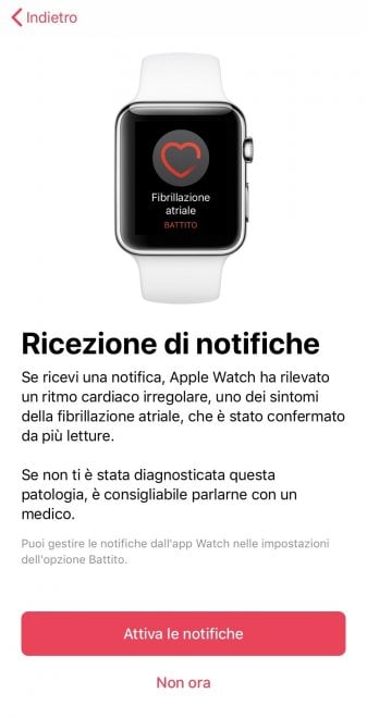 Apple Watch, ecco come funziona l'ECG