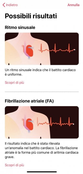 Apple Watch, ecco come funziona l'ECG