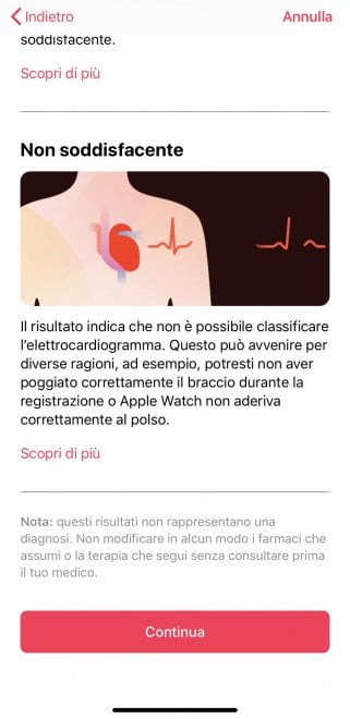 Apple Watch, ecco come funziona l'ECG