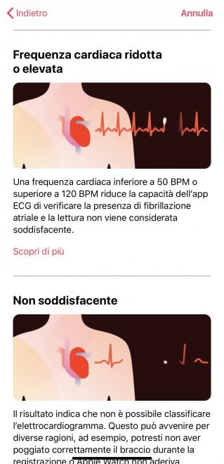Apple Watch, ecco come funziona l'ECG