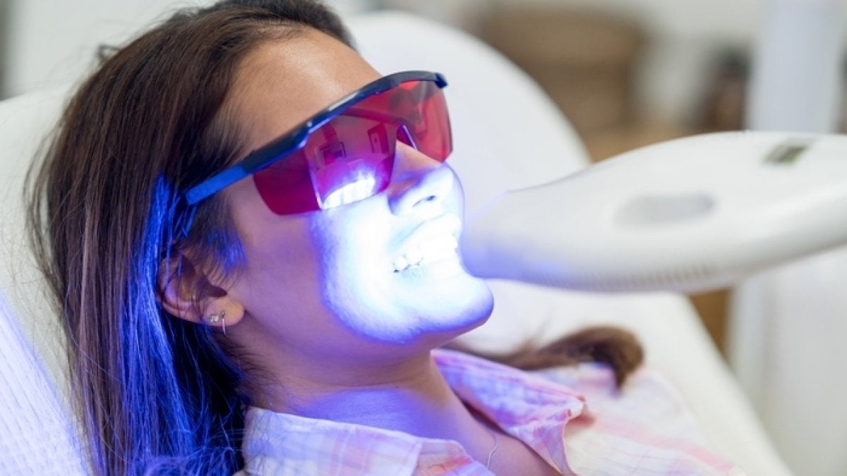 prodotti per sbiancare i denti