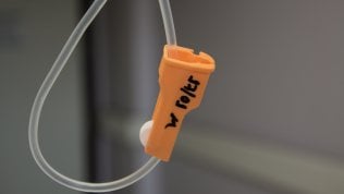 Mieloma multiplo, nuove speranze dalla terapia con CAR-T