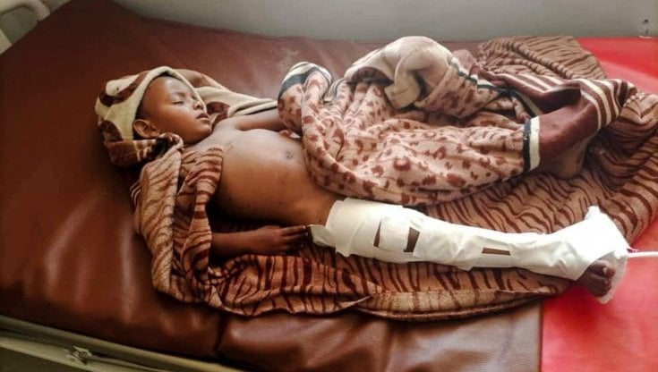 Un bambino tra i sopravvissuti dell'attacco aereo nel Tigray