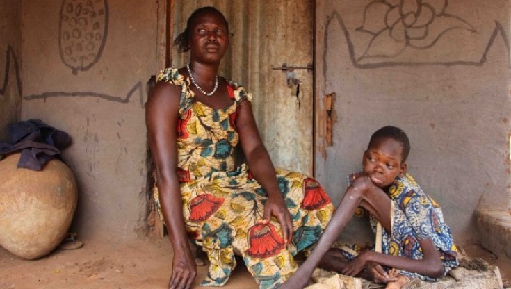 Sanità globale, le malattie dimenticate minacciano oltre un miliardo di persone nel mondo, ma nessuno ne parla