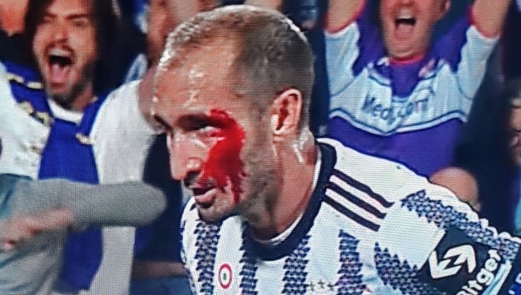 Giorgio Chiellini durante Fiorentina-Juventus