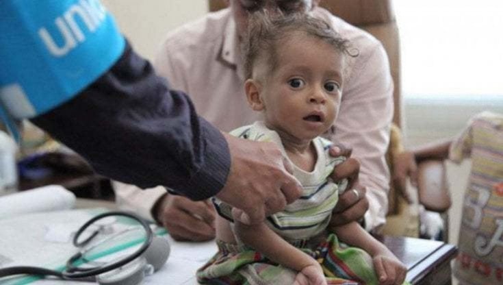 Yemen, più della metà della popolazione (17,5 milioni) ridotta alla fame: "Se in questa guerra non ci sarà una tregua, il cibo mancherà per tutti" 