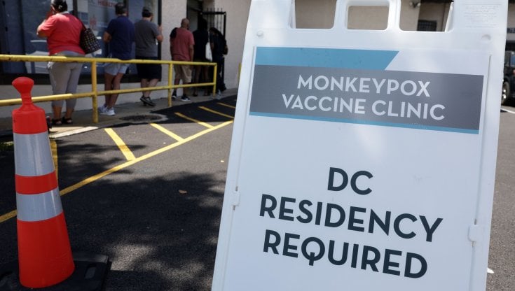 Vaiolo delle scimmie, le linee guida del Cdc: "Ridurre il numero di partner sessuali"