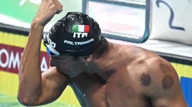 Quei segni a pois sulla pelle dei nuotatori, ecco cos'&egrave; il cupping
