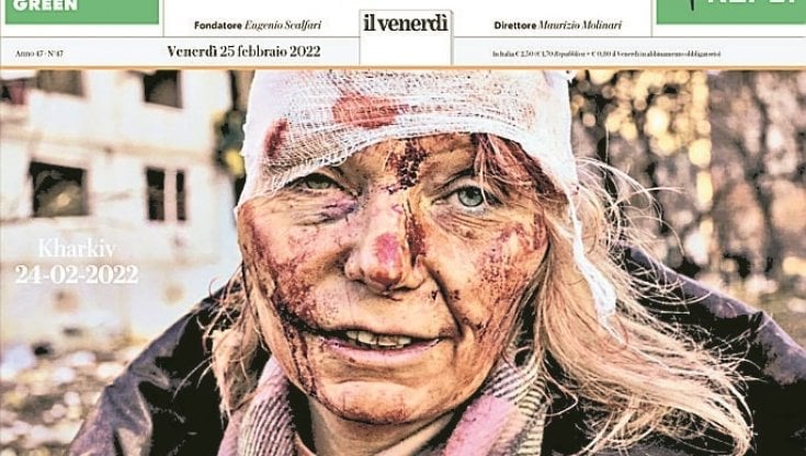 Ucraina, curata a Londra la donna della foto simbolo ma i troll russi la attaccano: “ È un'attrice”