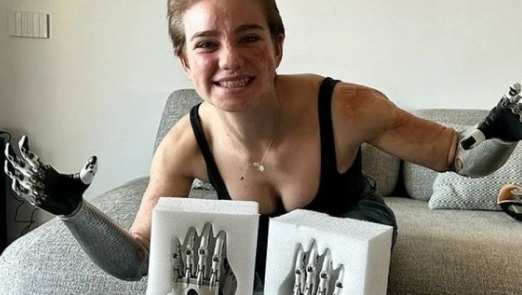 La campionessa italiana di fioretto individuale paralimpico Bebe Vio mostra sui social le sue nuove protesi