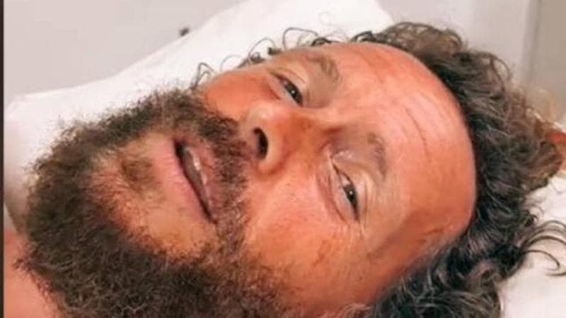 Jovanotti, incidente in bici a Santo Domingo. Clavicola e femore fratturati. “Fa malissimo dovrò operarmi”