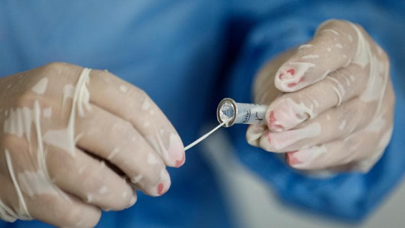 Covid, anche se prescrizioni e divieti sono caduti ai positivi si raccomanda di restare a casa