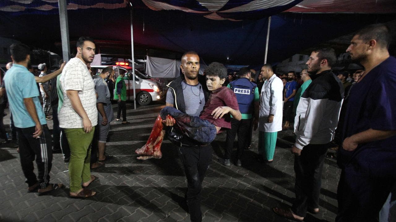 Un bambino ferito viene portato all'ospedale di Al-Shifa
