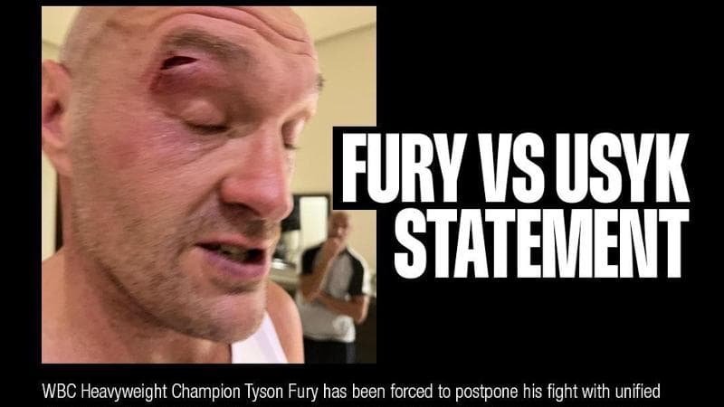 Il comunicato che annuncia il forfait di Fury