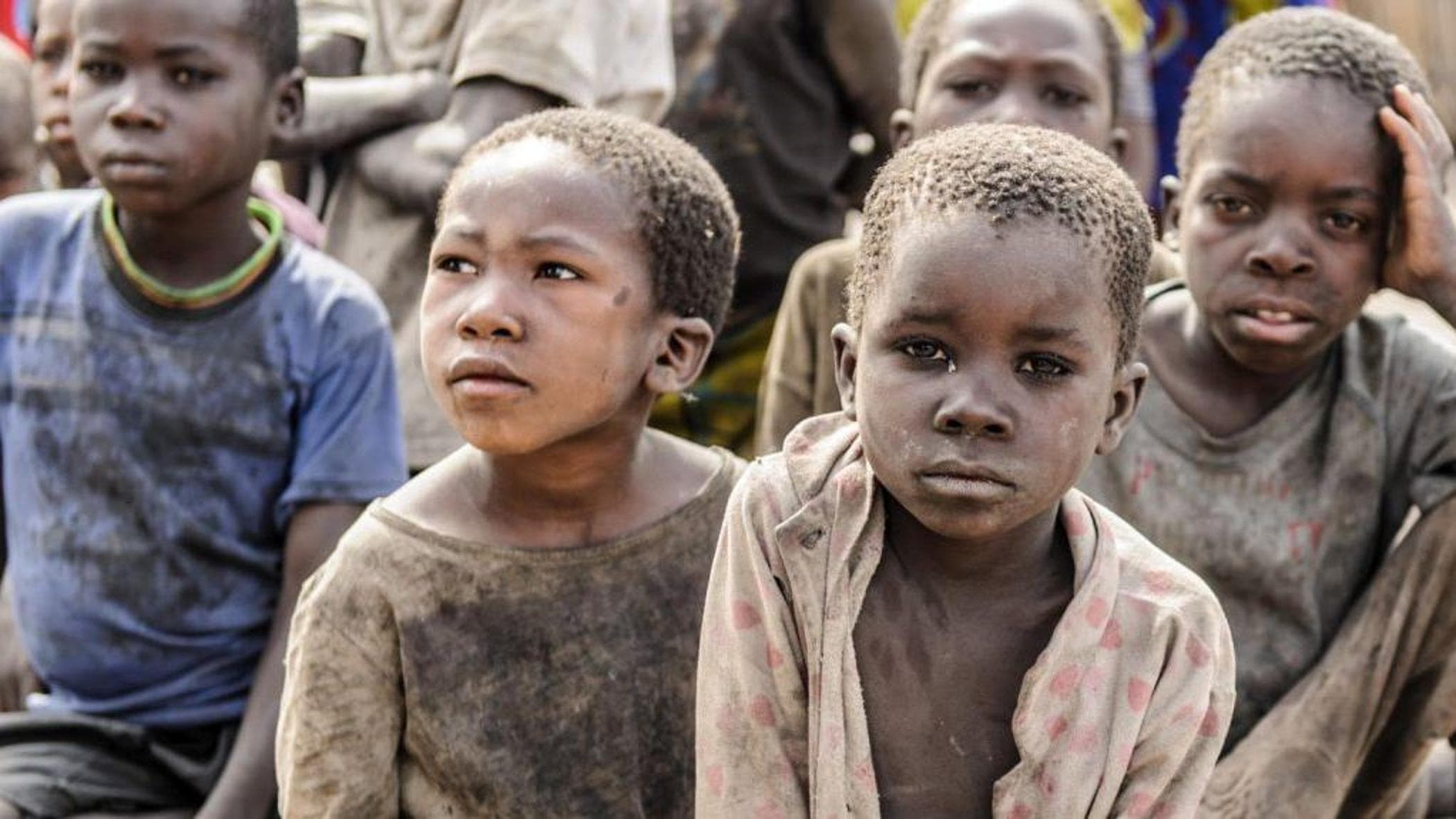 Uganda, Güney Sudan: Dünyanın Güneyindeki göz kanseri ve CBM adlı STK'nın çağrısıyla Dot'un hikayesi