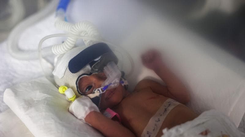 Gaza, è morta Sabreen, la neonata che era diventata simbolo della speranza nella Striscia