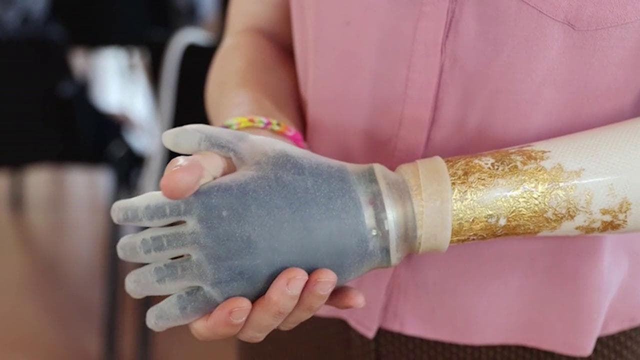 Al Festival della robotica, la protesi che sembra una mano vera: si muove con i muscoli del braccio