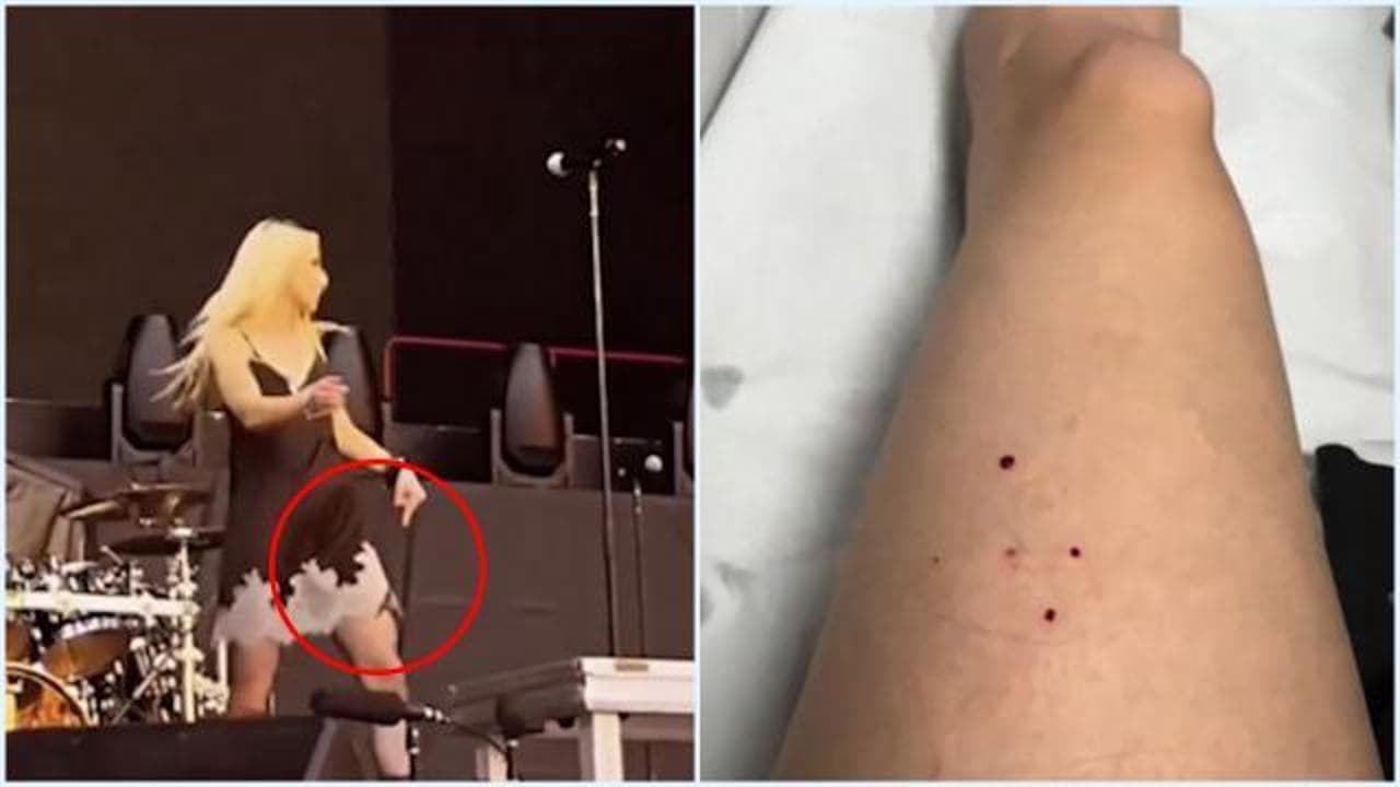 Siviglia, la rockstar morsa da un pipistrello durante il concerto: “Sono Batgirl”